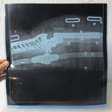 Vintage Genuine Medical X-Ray 14X14" of a Broken Limb Knee with Multiple Medical Surgical Plates, Screws and Straps, Human Skeleton