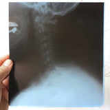 Vintage Genuine Medical X-Ray 8X8" of a Patient's Neck Cervical Vertebrae and Skull, Human Skeleton X-Ray, Thick Blue Plastic Sheet